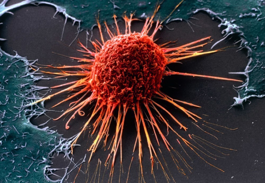 Бактерии Helicobacter pylori обвинили в провоцировании рака