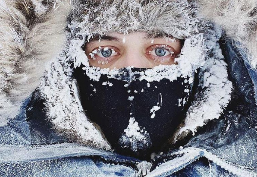 Обморожение: признаки и первая помощь