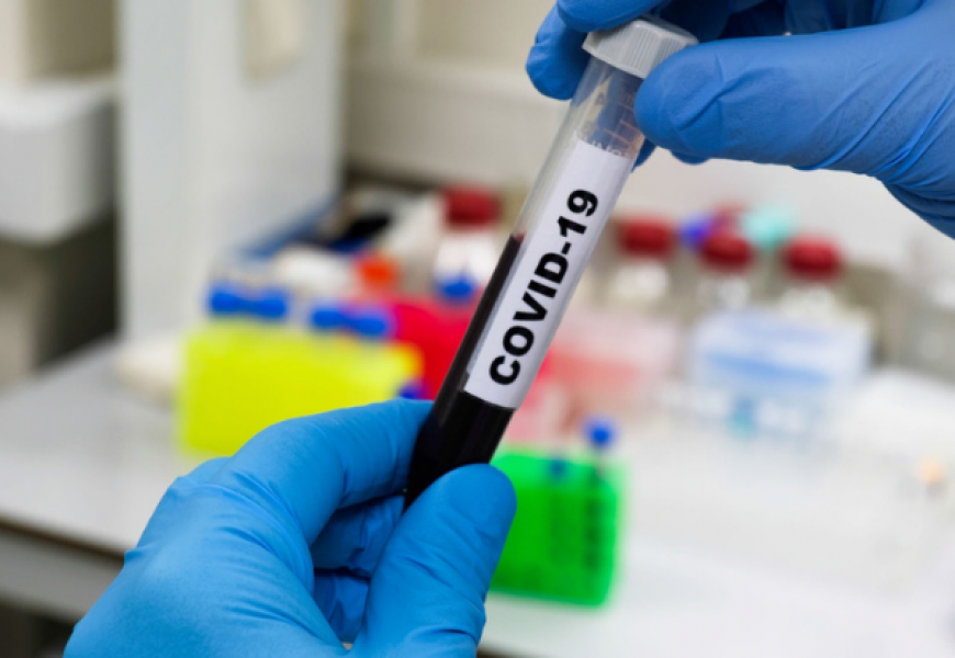 В Беларуси обнаружен собственный штамм COVID-19